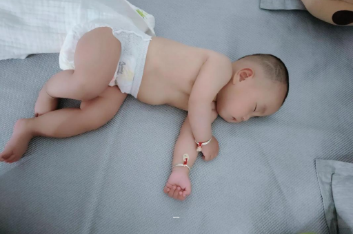 瑞安宝宝脸上有白色斑块